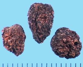  Heteromeles arbutifolia.  Black and red colored achenes are enclosed in fruit tissue. 