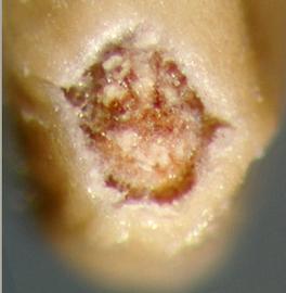  Rhaponticum repens.  Stylar lobe.Photo by Julia Scher, USDA-APHIS-PPQ.