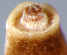  Cirsium arvense.  Achenes with a small stylar knob. Photo by Julia Scher, USDA-APHIS-PPQ.