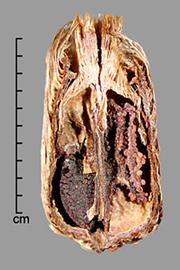  Melastoma malabathricum.  Young seed in capsule. Photo by Julia Scher, USDA-APHIS-PPQ.