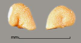  Melastoma malabathricum.  The seed embryo lies in a partial coil with the wide end terminating in the back of the hilum. Photo by Julia Scher, USDA-APHIS-PPQ.