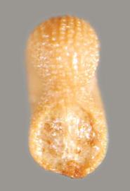  Melastoma malabathricum.  Hilum is wide and round and is lateral to the base of the seed. Photo by Julia Scher, USDA-APHIS-PPQ.