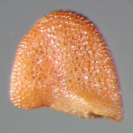  Melastoma sanguineum.  Reticulated seeds. Photo by Julia Scher, USDA-APHIS-PPQ.