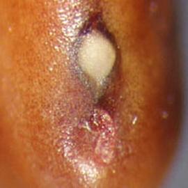  Mimosa diplotricha.  Seed hilum. Photo by Julia Scher, USDA-APHIS-PPQ.