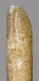  Solanum torvum.  True seeds with a present reticulum, but at various intensities. Photo by Julia Scher, USDA-APHIS-PPQ.