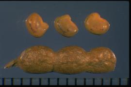  Alhagi maurorum.  True seeds top; Pod, bottom. Photo courtesy of Colorado State University, Department of Soil and Crop Sciences.
