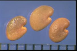  Astragalus pectinatus.  True seed with a wavy, smooth to irregular pitted texture. Photo courtesy of Colorado State University, Department of Soil and Crop Sciences.