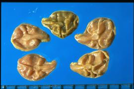  Senna covesii.  True seeds with large, irregular wrinkles on a shiny surface. 