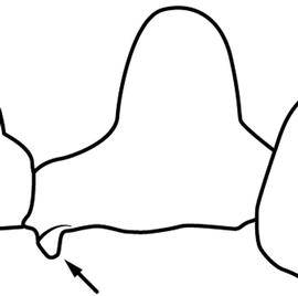 Lateral view of petiole, adult worker. The subpetiolar process is well developed as a flange or lobe. The process is located at the far anterior end of the petiole and maybe be difficult to see on most specimens. Used in Antkey to separate  Solenopsis xyloni  from  Solenopsis geminata .