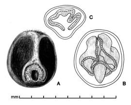  A, seed; B, longitudinal section of seed showing embryo  in situ ; D, transection of seed; drawing by Lynda E. Chandler 