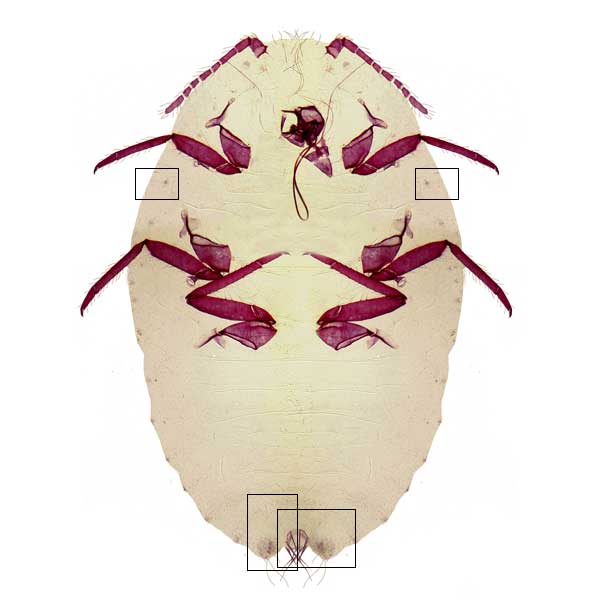 jpg photomicrograph image of Crisicoccus azaleae