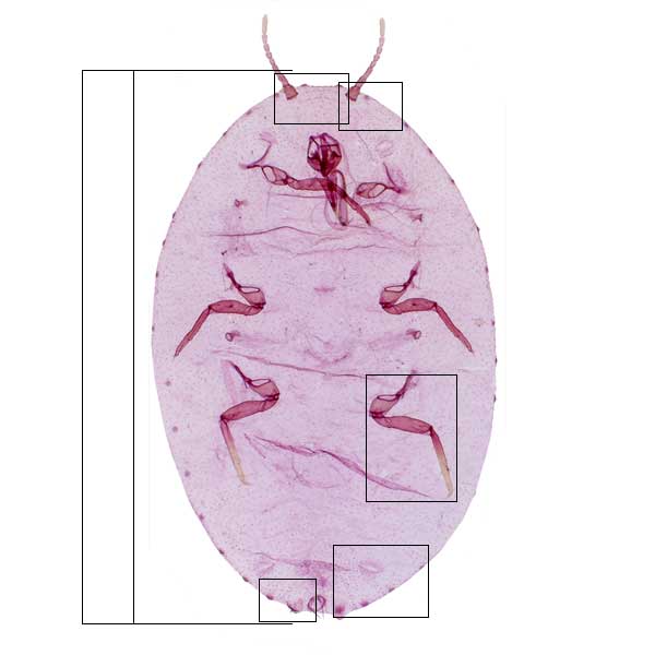 jpg photomicrograph image of Dysmicoccus near bispinosus