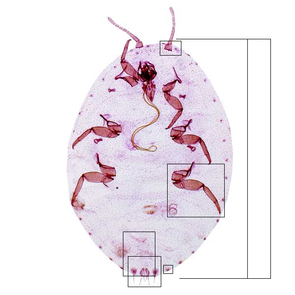 jpg photomicrograph image of Dysmicoccus neobrevipes