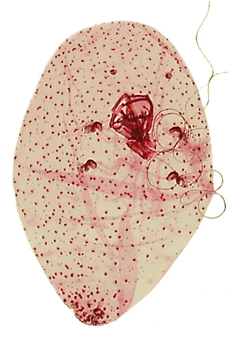  Polliniinae group:  Pollinia pollini  