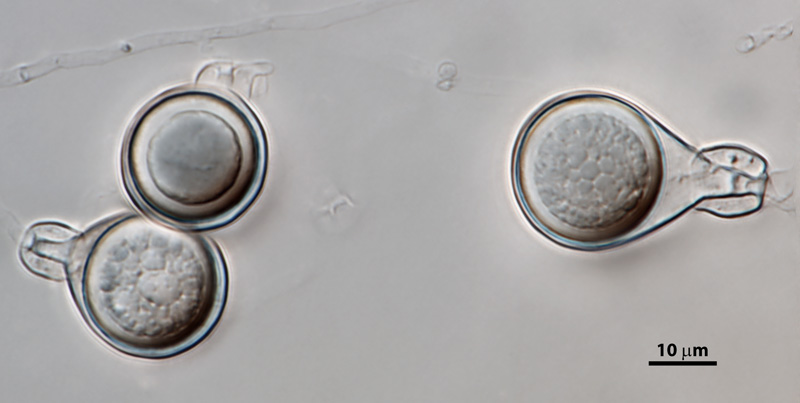   Phytophthora heveae nbsp;(P10167, selected specimen) homothallic sexual phase: smooth-walled oogonianbsp;with tapered bases; amphigynous antheridianbsp;and aplerotic oospores; photo by Gloria Abad, USDA-APHIS-PPQ. 
