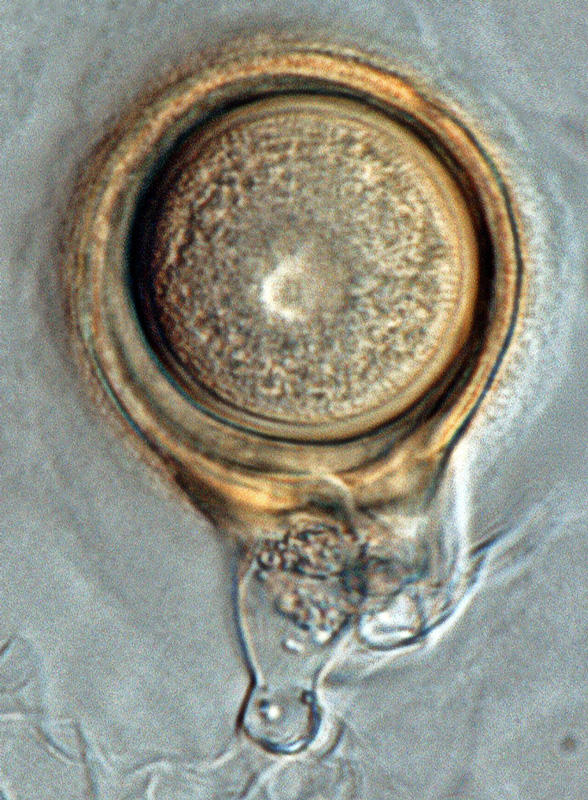   Phytophthora ideai  (ex-type CPHST BL 38) sexual phase: smooth-walled, pigmented oogonium with tapered base and paragynous antheridium; photo by Gloria Abad, USDA-APHIS-PPQ. 
