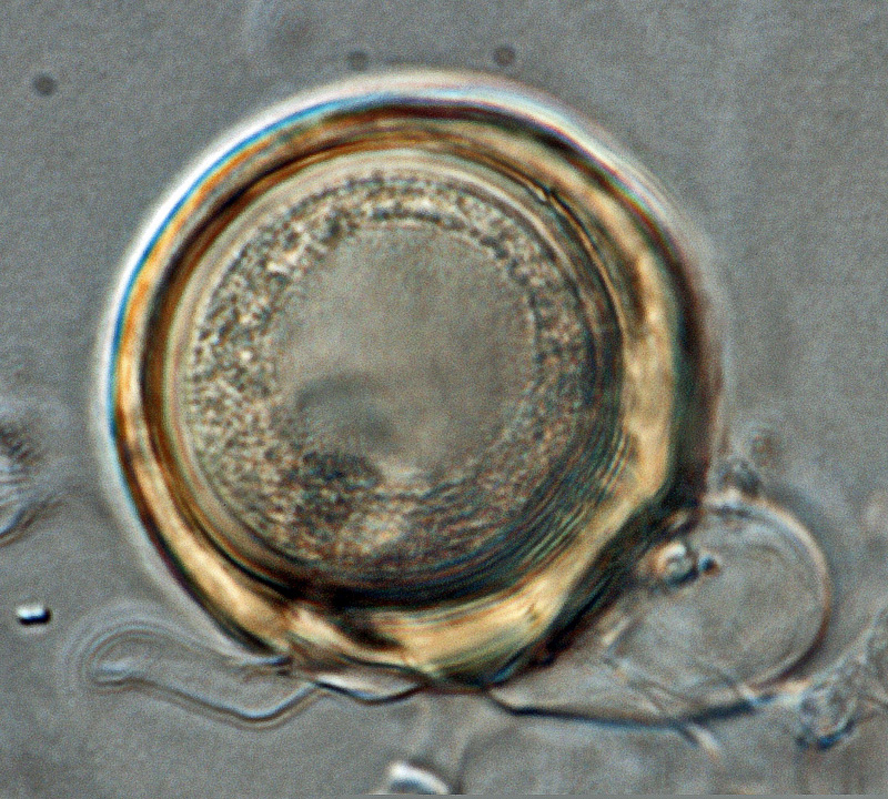  Phytophthora ideai  (ex-type CPHST BL 38) sexual phase: smooth-walled, pigmented oogonium with and paragynous antheridium;nbsp;photonbsp;by Gloria Abad, USDA-APHIS-PPQ. 
