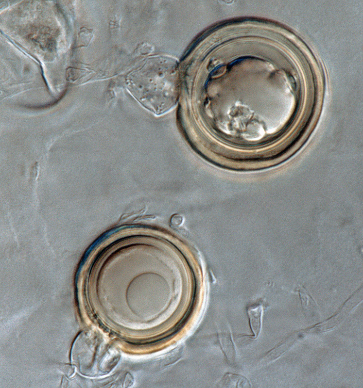   Phytophthora ideai  (ex-type CPHST BL 38) sexual phase: smooth-walled, pigmented oogonia with amphyginous antheridia;nbsp;photonbsp;by Gloria Abad, USDA-APHIS-PPQ. 
