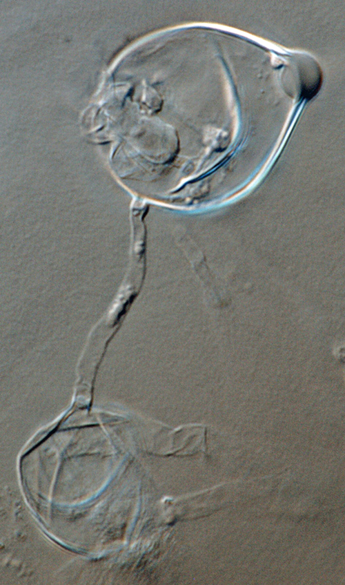   Phytophthora ideai nbsp;(ex-type CPHST BL 38) asexual phase: papillate sporangium with external proliferation; photonbsp;by Gloria Abad, USDA-APHIS-PPQ. 
