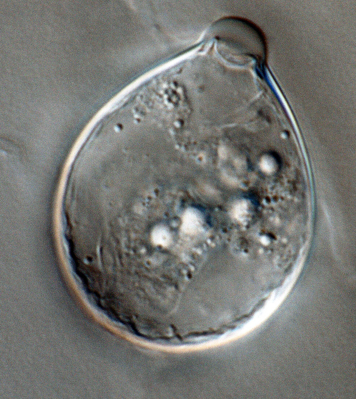   Phytophthora ideai nbsp;(ex-type CPHST BL 38) asexual phase: papillate sporangium; photonbsp;by Gloria Abad, USDA-APHIS-PPQ. 

