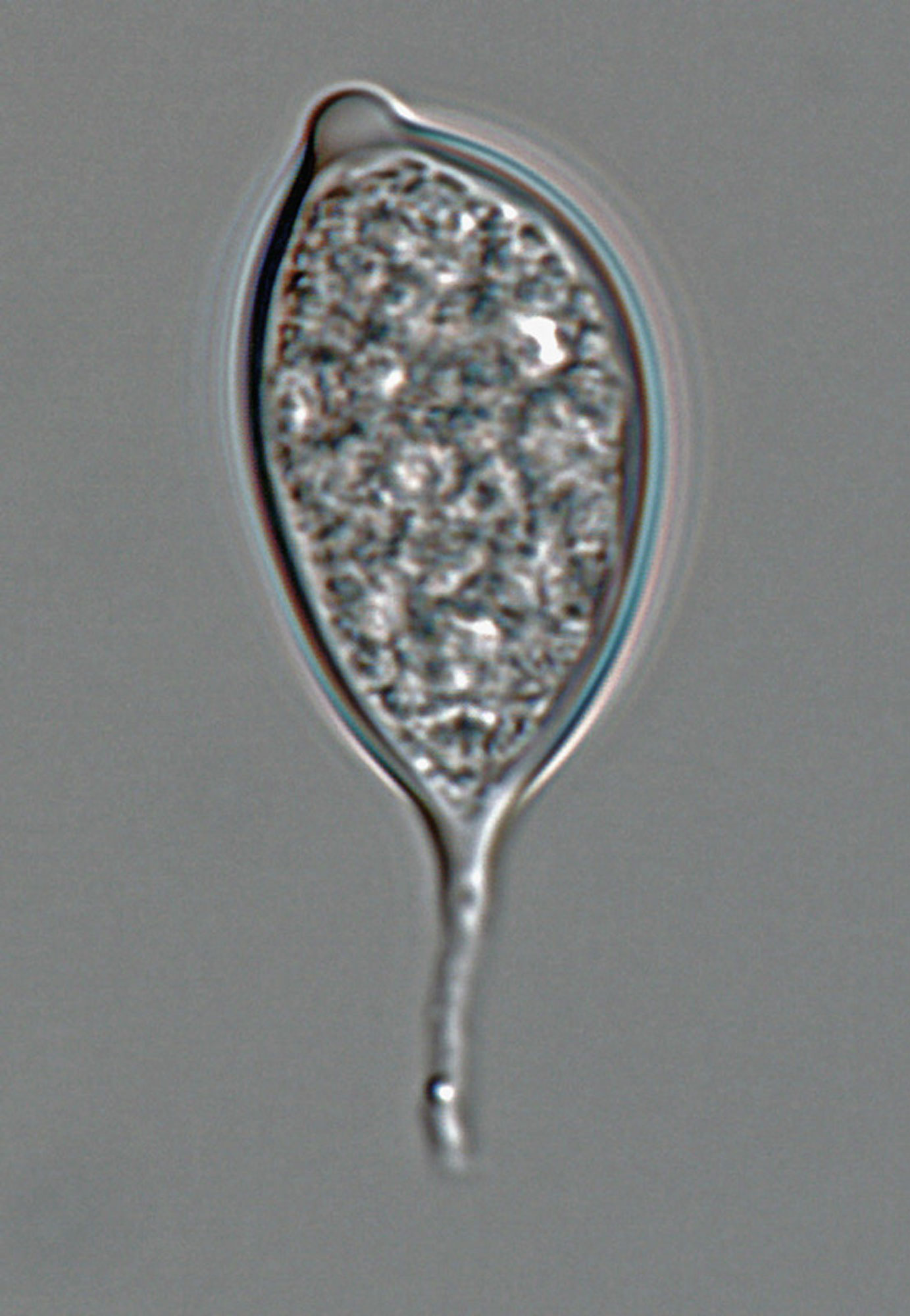   Phytophthora morindae  (CPHST BL 49G, ex-type) asexual phase: caducous papillate sporangium with short pedicel; photo by Gloria Abad, USDA-APHIS-PPQ. 
