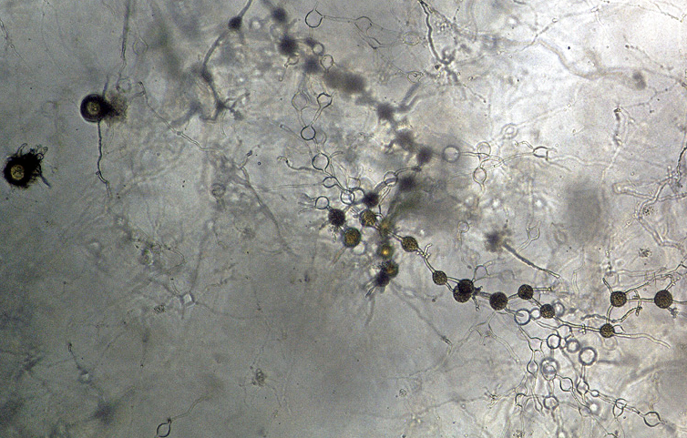   Phytophthora multivesiculata nbsp;(CPHST BL 50G, ex-type) asexual phase: globose and catenulate hyphal swellings; photonbsp;by Gloria Abad, USDA-APHIS-PPQ. 
