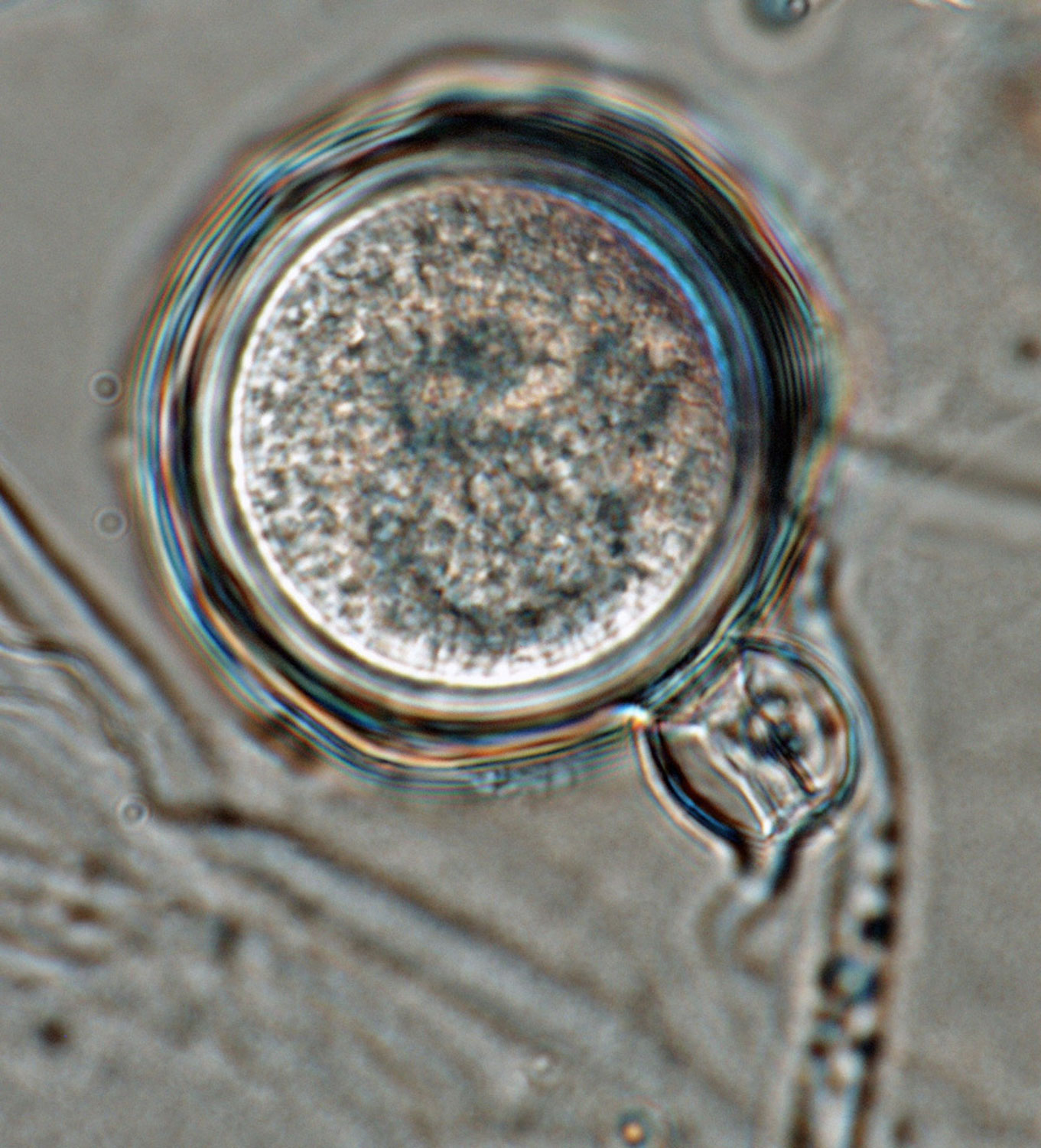   Phytophthora multivesiculata nbsp;(CPHST BL 50G, ex-type) sexual phase:nbsp;plerotic oosporenbsp;withnbsp;predominantlynbsp;amphigynous antheridium with digitate projection; photonbsp;by Gloria Abad, USDA-APHIS-PPQ. 
