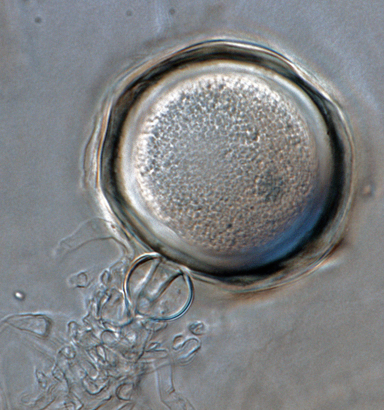   Phytophthora multivesiculata nbsp;(CPHST BL 50G, ex-type) sexual phase:nbsp;plerotic oosporenbsp;withnbsp;predominantlynbsp;amphigynous antheridium; photonbsp;by Gloria Abad, USDA-APHIS-PPQ. 
