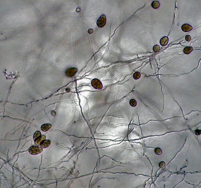 Phytophthora erythroseptica (in progress - Abad et al. 2023b) | IDphy