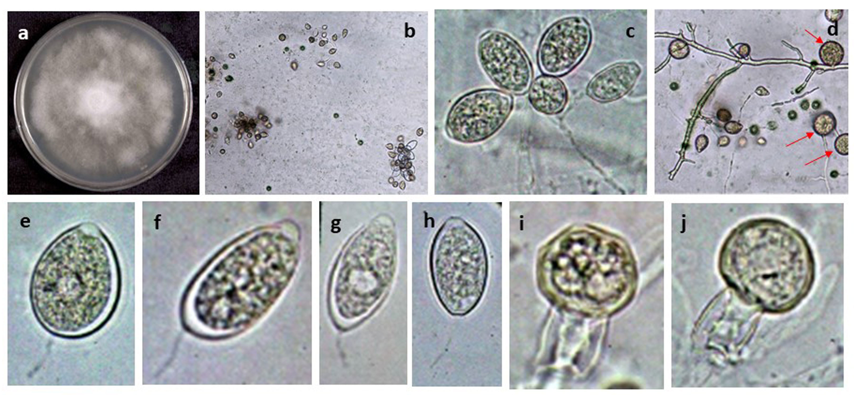   Phytophthora botryosa  (Abad Ph450) selected specimen: (a) colony on V-8 agar, (b-h) semipapillated sporangia, (b) produced in botryose clumps, (c) sporangia produced in botryose simple sympodial sporangiophore; (e-h) sporangia with medium-length pedicel; (d) chlamydospores (arrows); (i, j) oogonia with amphigynous antheridia produced after pairings with opposite type; photos by G. Abad, USDA-APHIS-PPQ 
