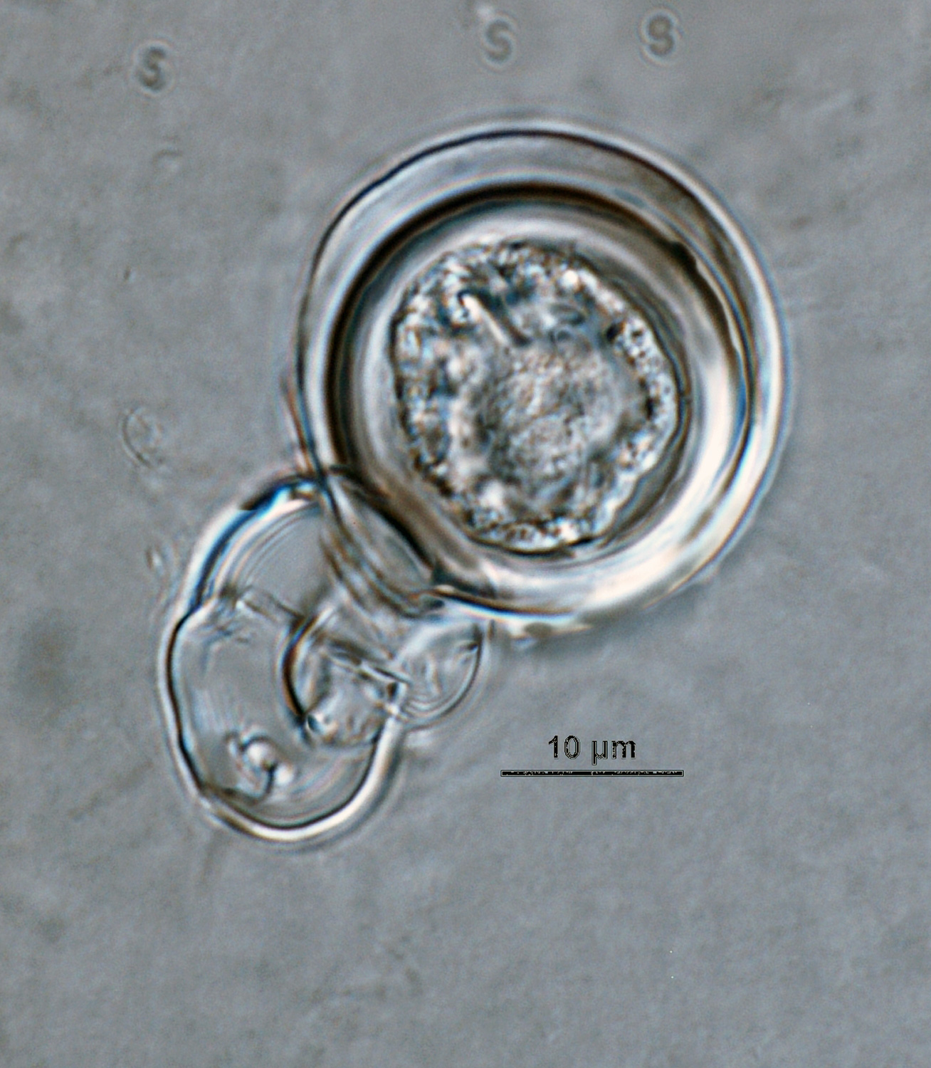   Phytophthora capsici nbsp;(ex-type CPHST BL 33) heterothallic sexual phase: smooth-walled oogonium with amphigynous antheridium and aplerotic oospore; photo by Gloria Abad, USDA-APHIS-PPQ. 
