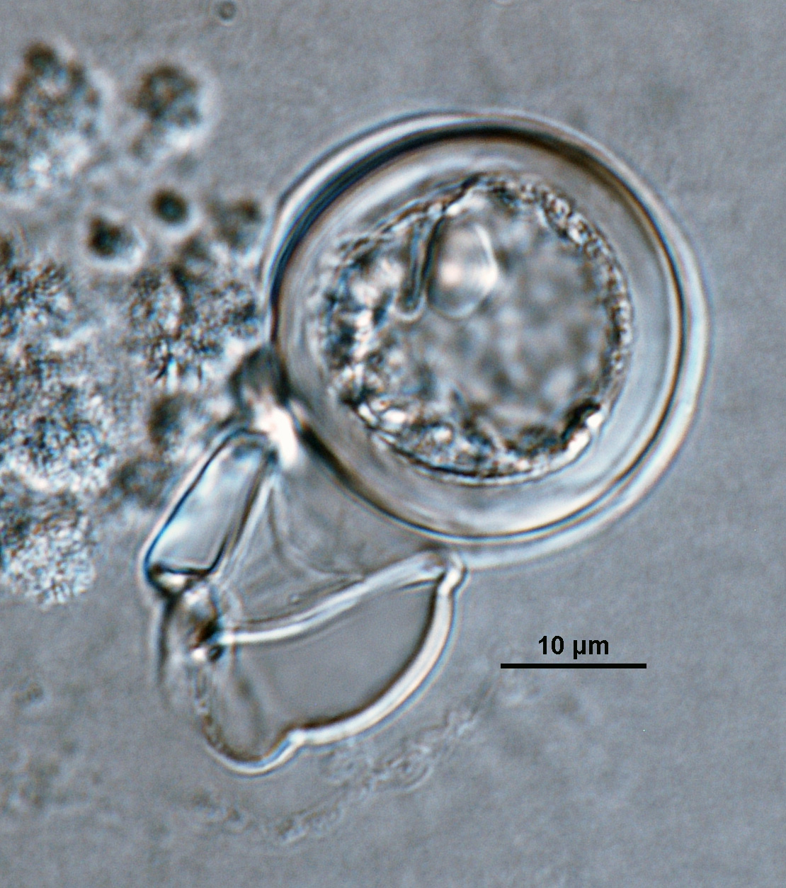   Phytophthora capsici nbsp;(ex-type CPHST BL 33) heterothallic sexual phase: smooth-walled oogonium with amphigynous antheridium and plerotic oospore; photo by Gloria Abad, USDA-APHIS-PPQ. 
