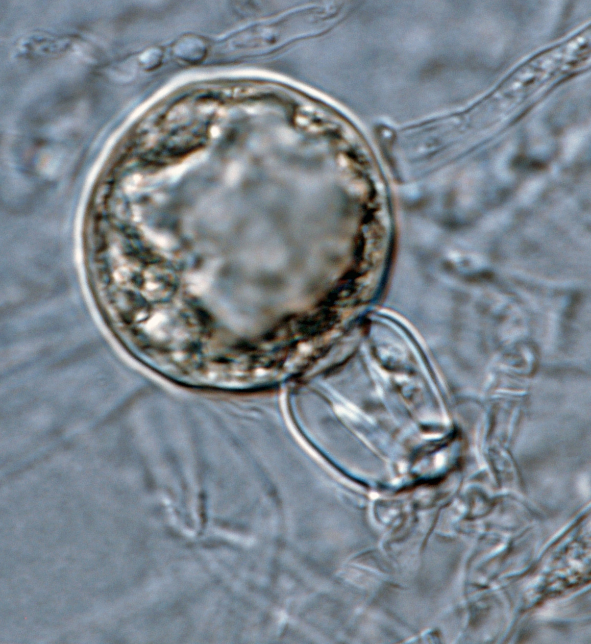   Phytophthora capsici nbsp;(ex-type CPHST BL 33) heterothallic sexual phase: young oogoniumnbsp;with amphigynous antheridium; photo by Gloria Abad, USDA-APHIS-PPQ. 
