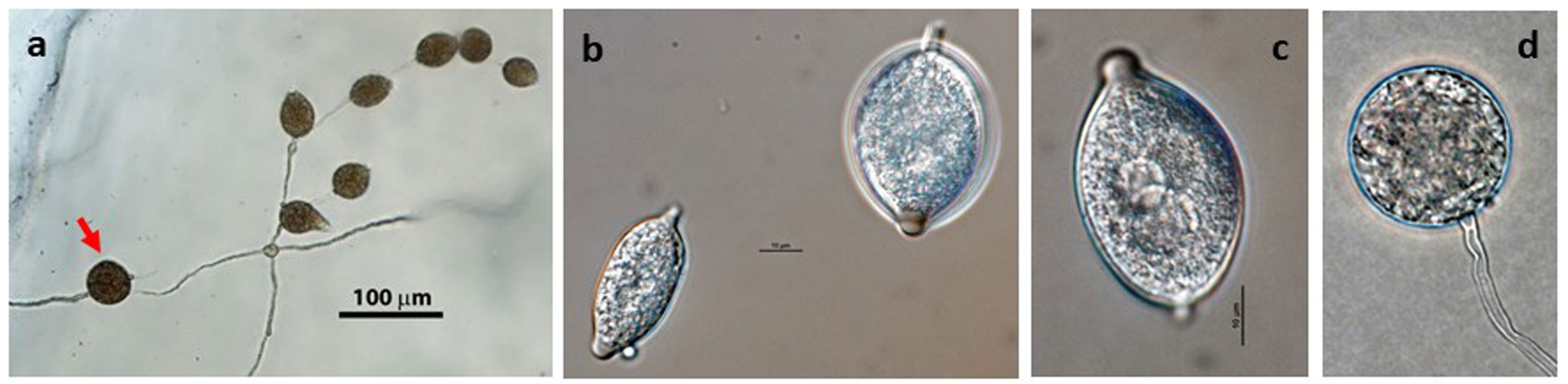   Phytophthora cactorum  (CPHST BL 9) asexual phase formed on V8 agar flooded with soil extract (a-c):nbsp;(a) sporangia originated in lax sympodial sporangiophore, chlamydospore in bottom left (arrow), (b) papillate caducous sporangia with short pedicel, (c) papillate caducous sporangium with short pedicel, (d) chlamydospore; photos by G. Abad, USDA-APHIS-PPQ. 
