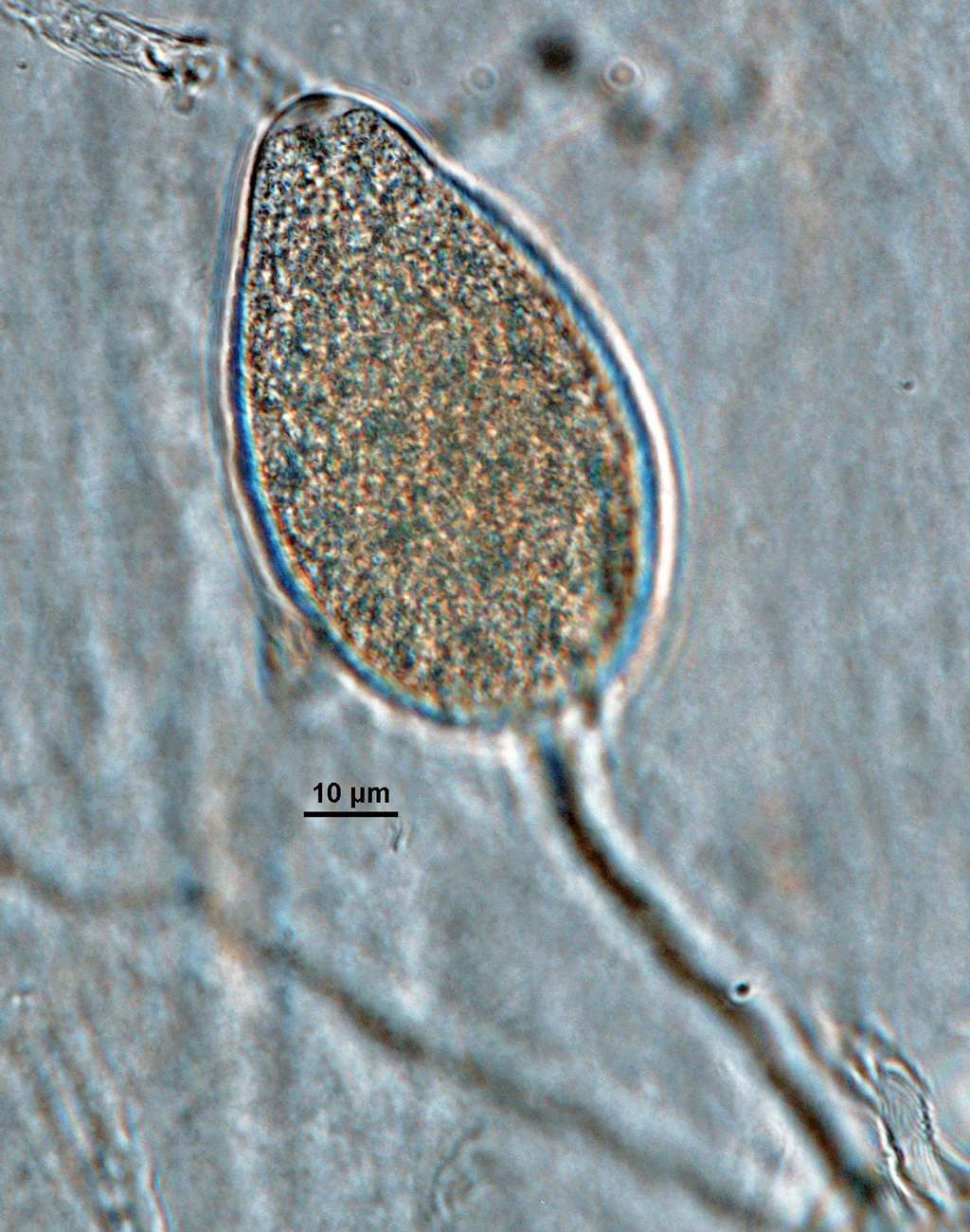   Phytophthora gonapodyides  (CPHST BL 172, selected specimen) asexual phase: nonpapillated sporangiumnbsp;produced in unbranched sporangiophore; photo by Gloria Abad, USDA-APHIS-PPQ. 
