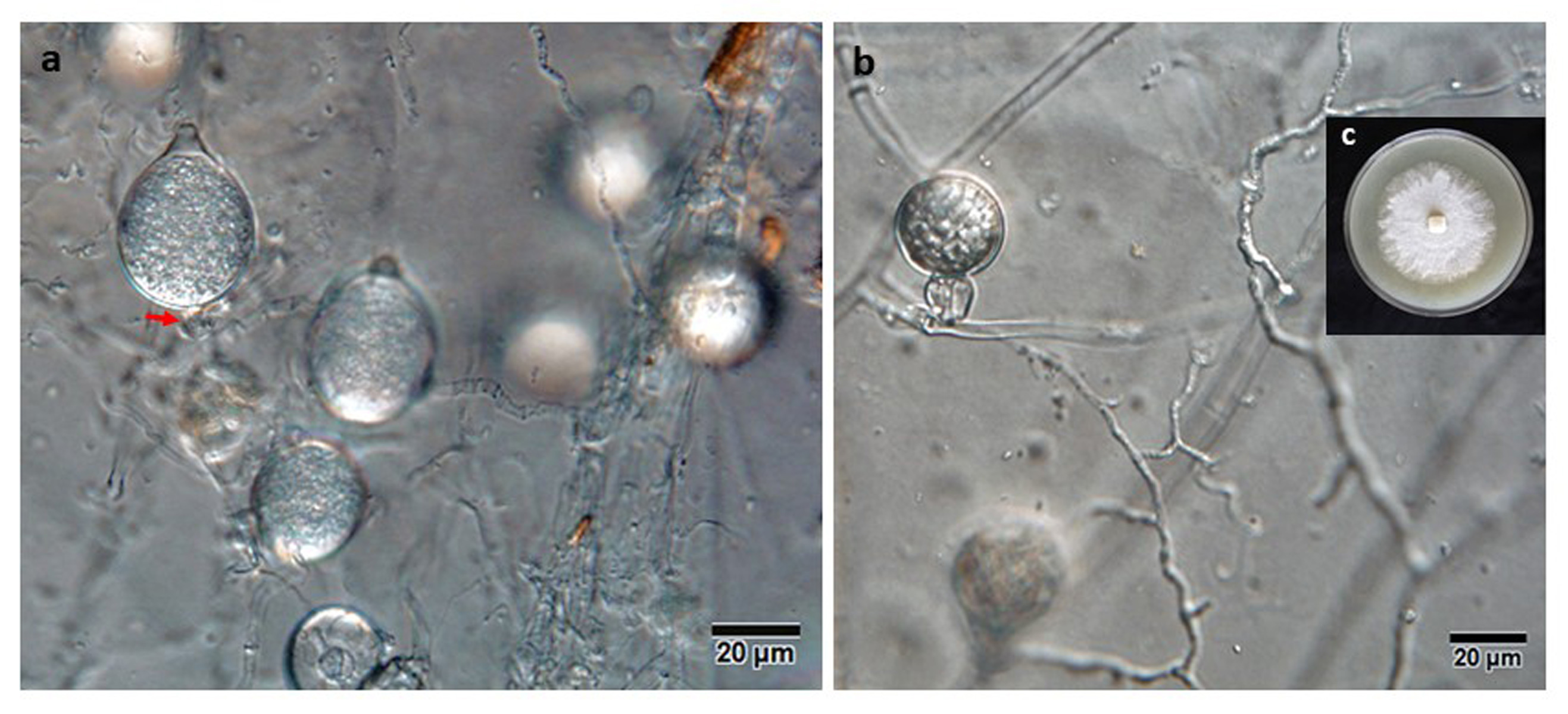   Phytophthora gondwanensis  (ex-type CBS 139336) colony morphology, asexual and sexual phases: (a) sporangia papillated, with short pedicel (red arrow); (b) smooth-walled oogonium with amphigynous antheridium and plerotic oospore; (c) colony morphology in 10% V8 agar; photos by Lucas A. Shuttleworth, University of Sidney, Australia. 
