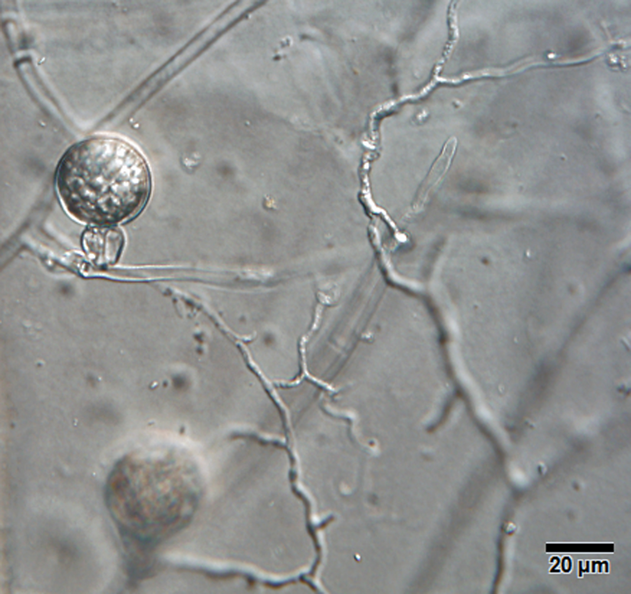  Phytophthora gondwanensis nbsp;(ex-type CBS 139336)nbsp;sexual phase: smooth-walled oogonium with amphigynous antheridium and plerotic oospore; photonbsp;by Lucas A. Shuttleworth, University of Sidney, Australia. 
