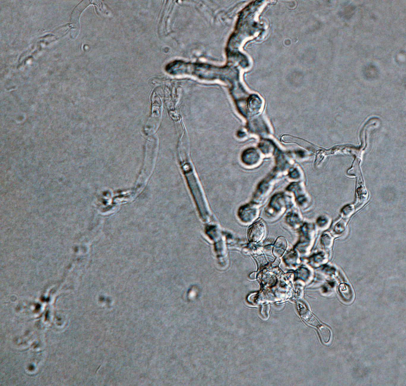 Phytophthora ilicis (in progress - Abad et al. 2023b) | IDphy