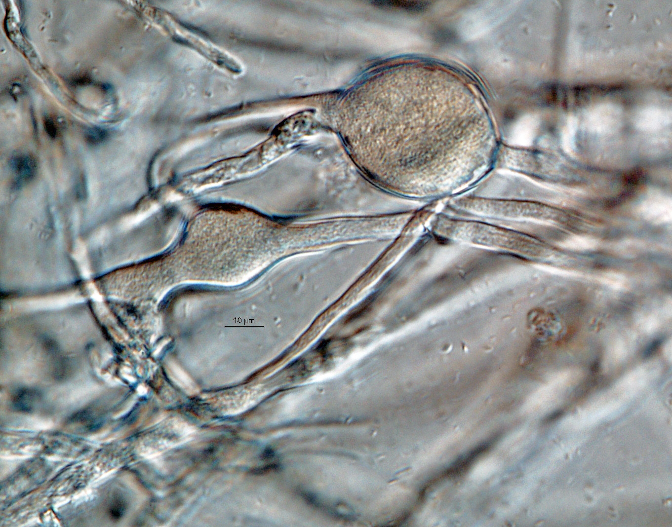   Phytophthora inundata nbsp;(CPHST BL 20, selected specimen) asexual phase: variably shapped hyphal swellings;nbsp;photonbsp;by Gloria Abad, USDA-APHIS-PPQ. 

