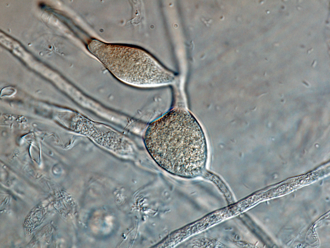   Phytophthora inundata nbsp;(CPHST BL 20, selected specimen) asexual phase: variably shapped hyphal swellings;nbsp;photonbsp;by Gloria Abad, USDA-APHIS-PPQ. 
