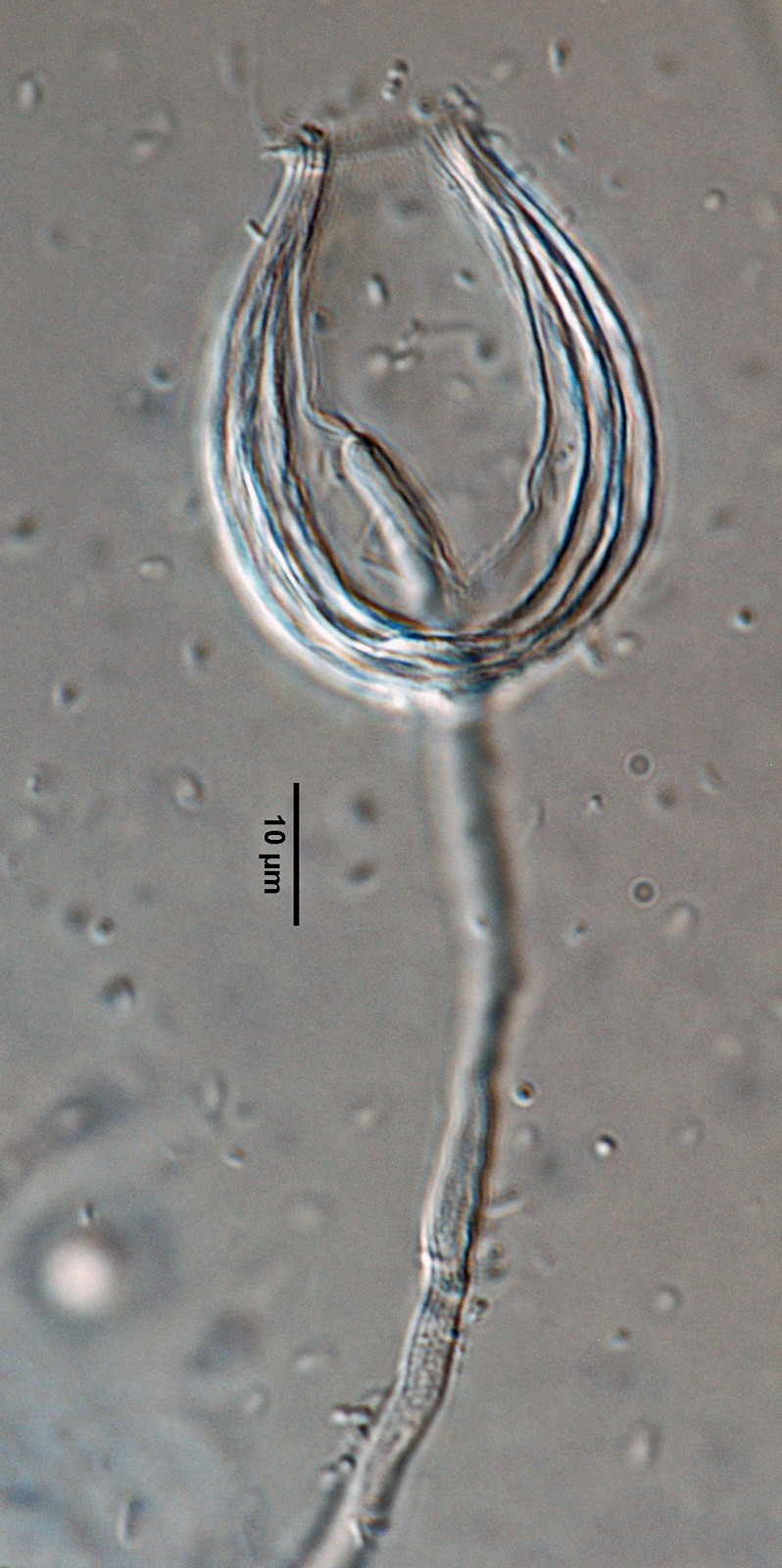   Phytophthora inundata  (CPHST BL 20, selected specimen) asexual phase: persistent sporangium with internal proliferation; photonbsp;by Gloria Abad, USDA-APHIS-PPQ. 
