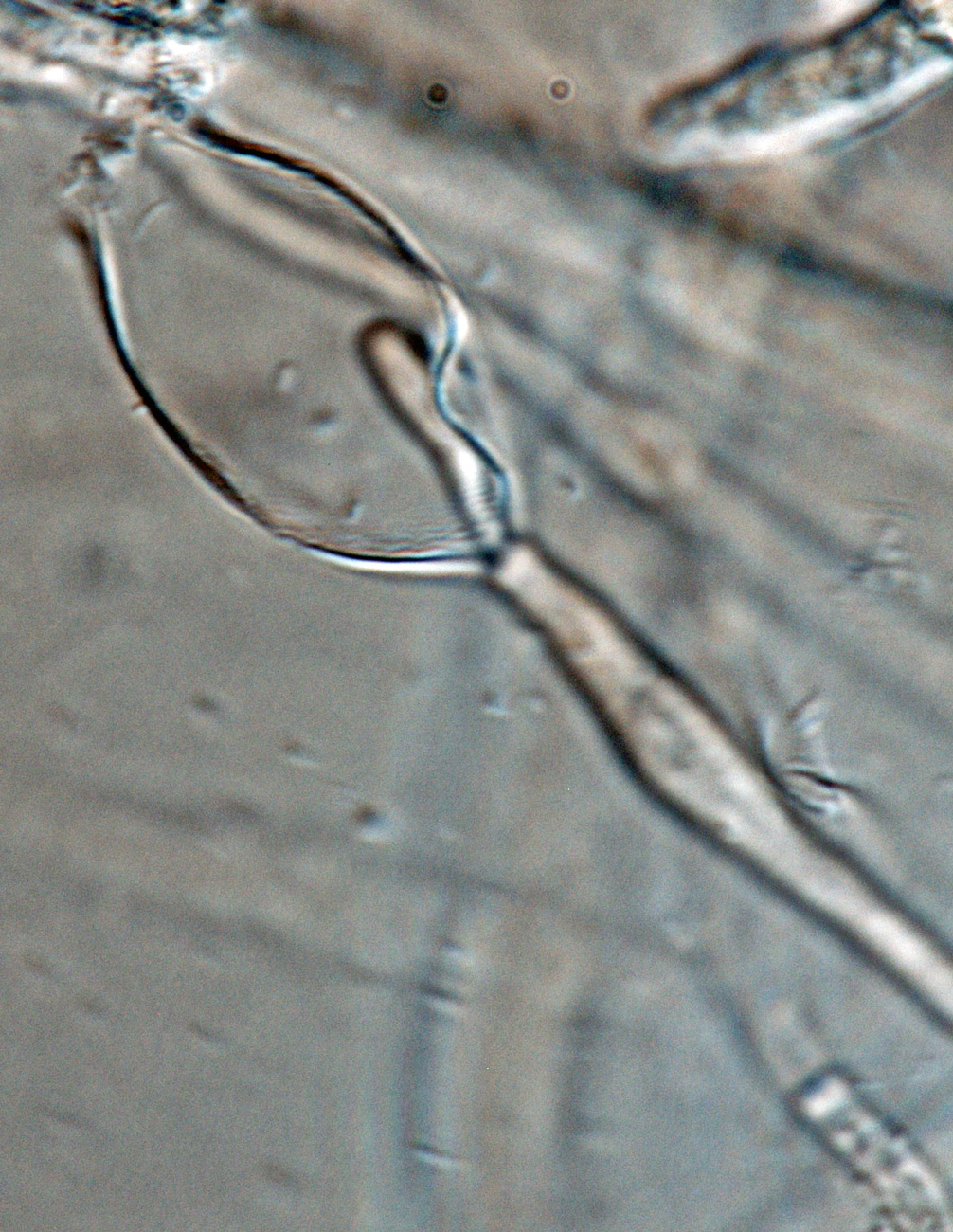   Phytophthora inundata nbsp;(CPHST BL 20, selected specimen) asexual phase: persistent sporangiumnbsp;with internal proliferation; photonbsp;by Gloria Abad, USDA-APHIS-PPQ. 
