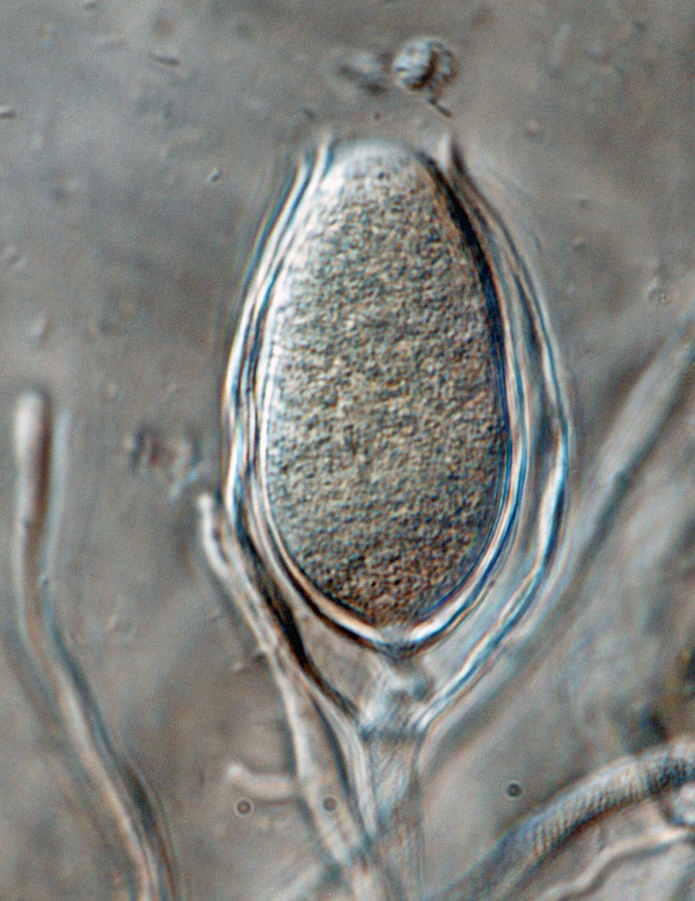  Phytophthora inundata nbsp;(CPHST BL 20, selected specimen) asexual phase: nonpapillate persistent sporangiumnbsp;with internal proliferation; photonbsp;by Gloria Abad, USDA-APHIS-PPQ. 
