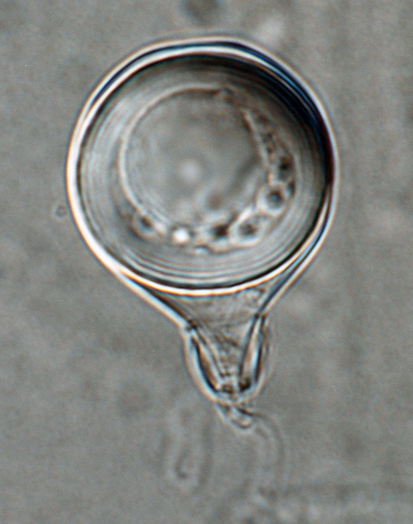   Phytophthora morindae  (CPHST BL 49G, ex-type) sexual phase: young plerotic oospore with thick wall, oogonium with tapered base and amphigynous antheridium; photo by Gloria Abad, USDA-APHIS-PPQ. 
