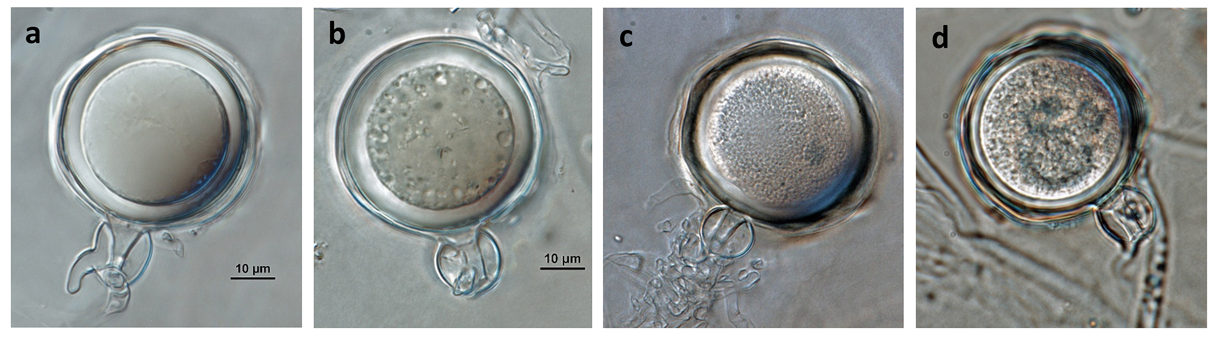   Phytophthora multivesiculata nbsp;(CPHST BL 50G, ex-type) sexual phase: plerotic oospores with predominantly amphigynous antheridianbsp;with digitate projections; photos by Gloria Abad, USDA-APHIS-PPQ. 
