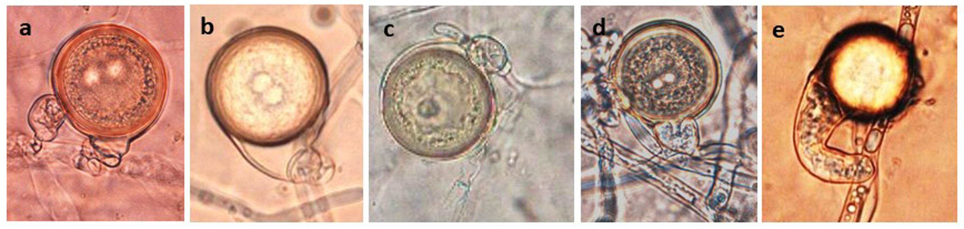   Phytophthora nagaii  (ex-type CH04PHR12) sexual phase: (andash;d) smooth-walled oogonia with aplerotic oospores; (b, c) with paragynous antheridia; (b) funnel-shaped oogonium; (c) paragynous antheridium with finger-like projection; (d) amphigynous antheridium; (e) distorted oogonium; photos by Mohamed Rahman and Koji Kageyama, Gifu University, Japan 
