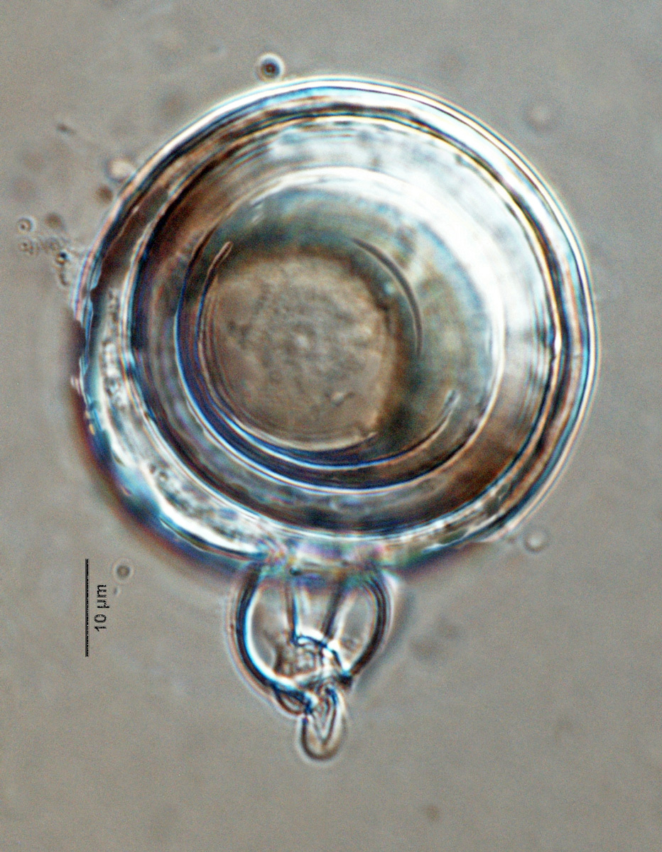   Phytophthora sansomeana  (ex-type CPHST BL 55) homothallic sexual phase: oogoniumnbsp;smooth-walled with predominant amphigynous antheridiumnbsp;with finger-like projection; photonbsp;by Gloria Abad, USDA-APHIS-PPQ. 

