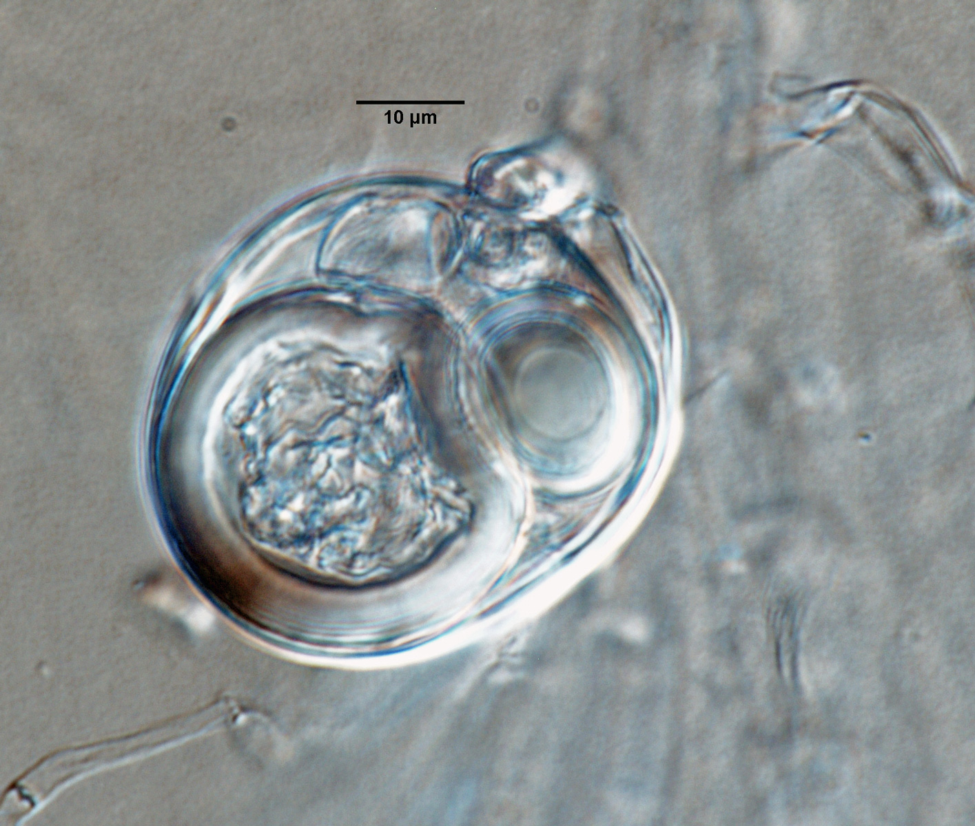  Phytophthora sansomeana nbsp;(ex-type CPHST BL 55) homothallic sexual phase: two oospores per oogonium; photonbsp;by Gloria Abad, USDA-APHIS-PPQ. 
