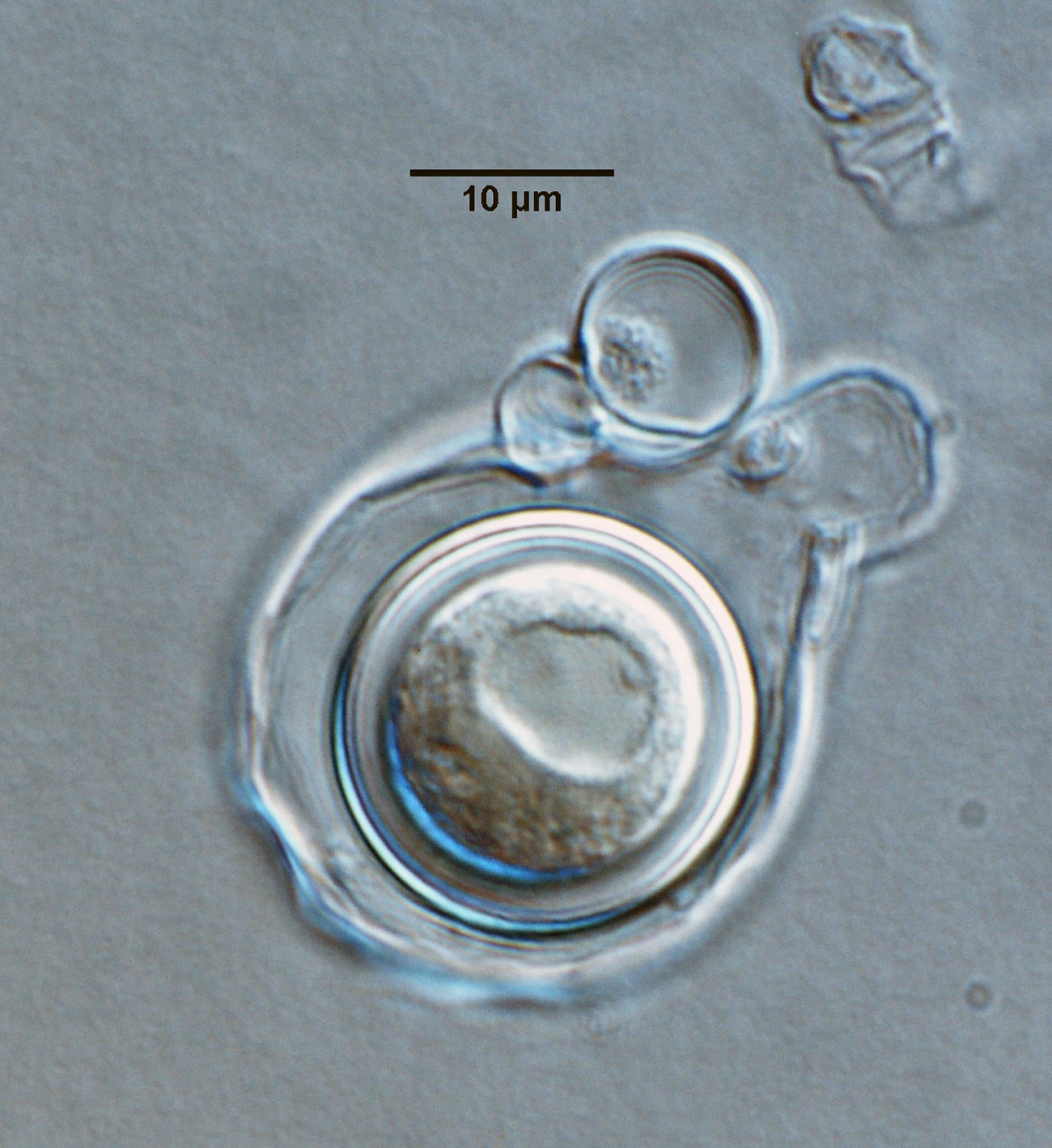   Phytophthora sansomeana nbsp;(ex-type CPHST BL 55) sexual phase: oogoniumnbsp;with apleroticnbsp;oospore; photonbsp;by Gloria Abad, USDA-APHIS-PPQ. 
