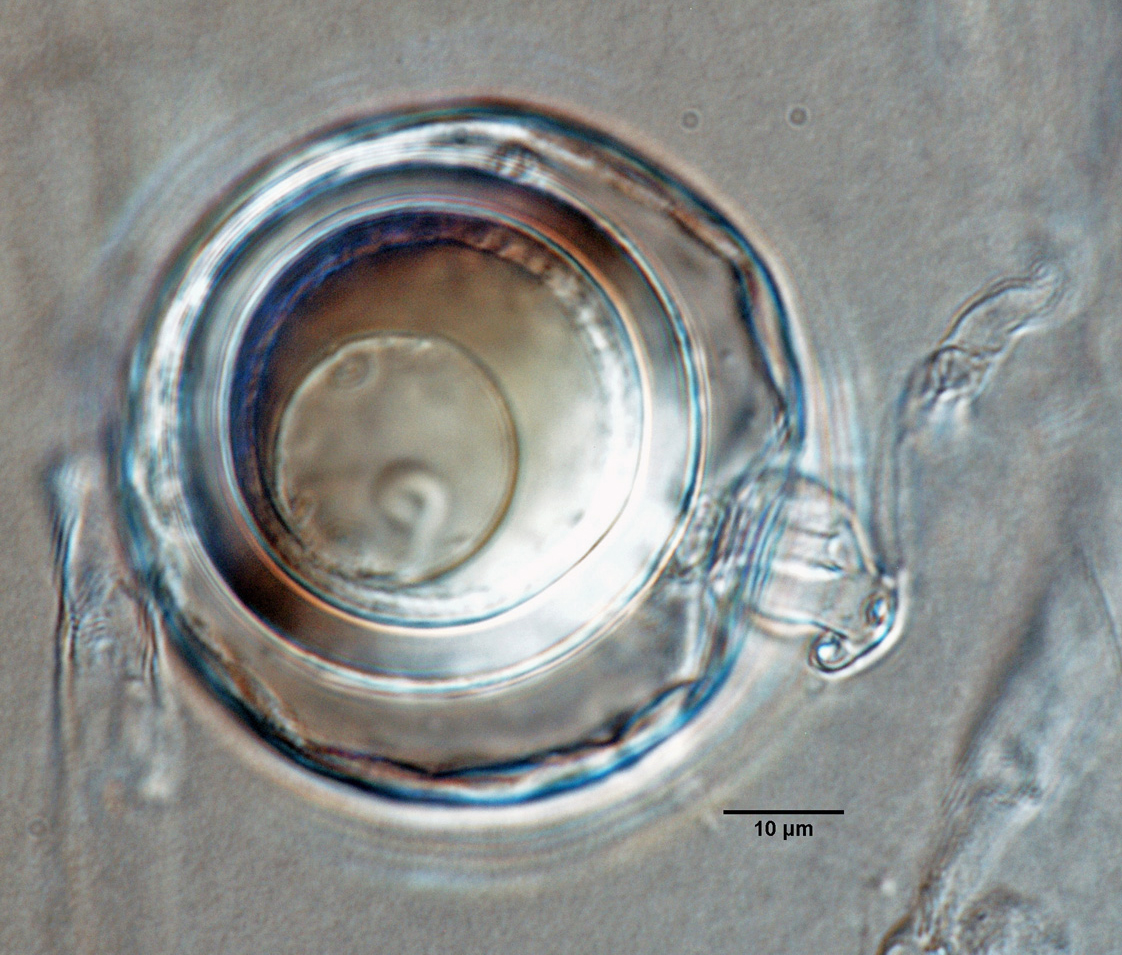   Phytophthora sansomeana nbsp;(ex-type CPHST BL 55) homothallic sexual phase: aplerotic oospore with smooth-walled oogonium and predominant amphigynous antheridium; photonbsp;by Gloria Abad, USDA-APHIS-PPQ. 
